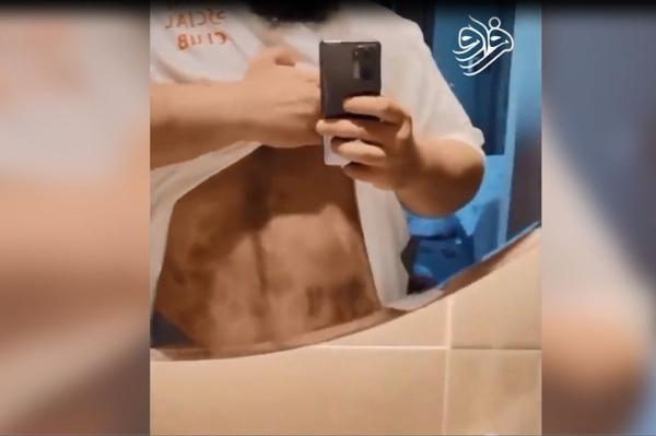 ماجرای شایعه ضرب و شتم هالک ایرانی؛ علت کبودی و زخم چه بود؟ ماجرای شایعه ضرب و شتم هالک ایرانی؛ دلیل کبودی و زخم چه بود؟